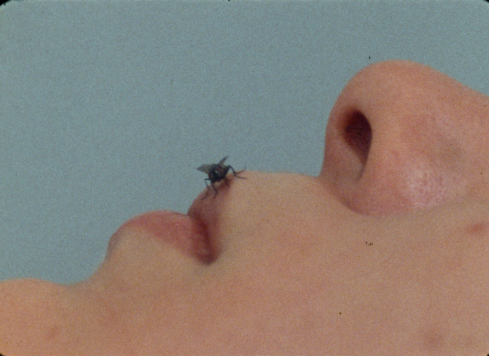 Close up of a light-skinned person's face with a fly resting on their upper lip